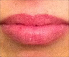 Lippen